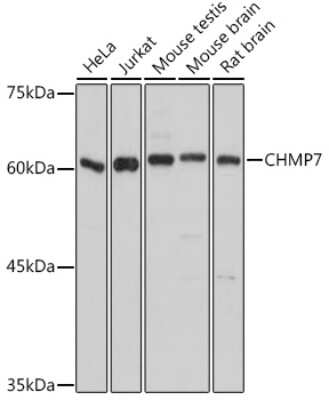 Western Blot: CHMP7 AntibodyAzide and BSA Free [NBP3-04842]